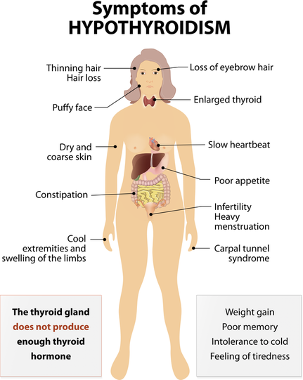 Image of drawing of woman with description of symptoms of hypothyroidism.  Text box on this page shows these symptoms